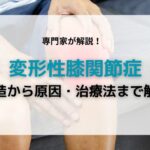 変形性膝関節症