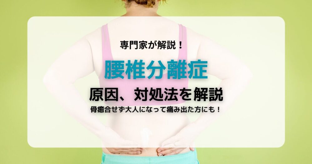 腰椎分離症