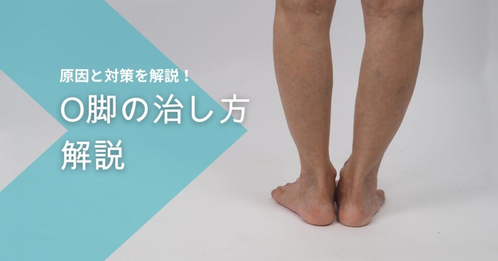 O脚の治し方